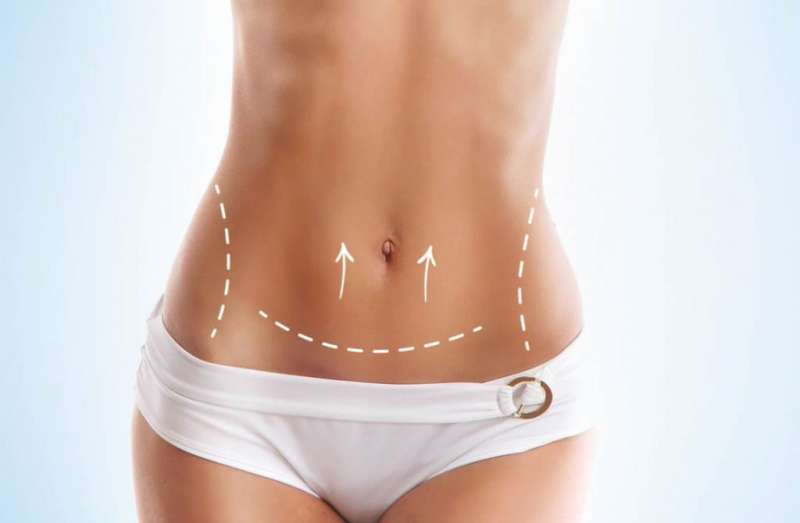 Tratamiento Cirugia de Abdominoplastia en Malaga 1