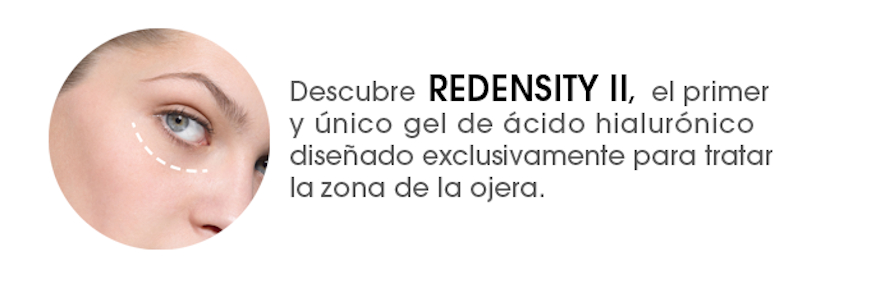 Tratamiento Tratamiento de ojeras con Redensity II 2