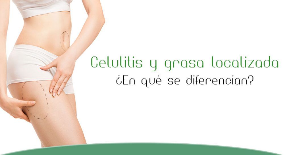 Blog Celulitis y grasa localizada que son en que se diferencian y su tratamiento medico estetico 1