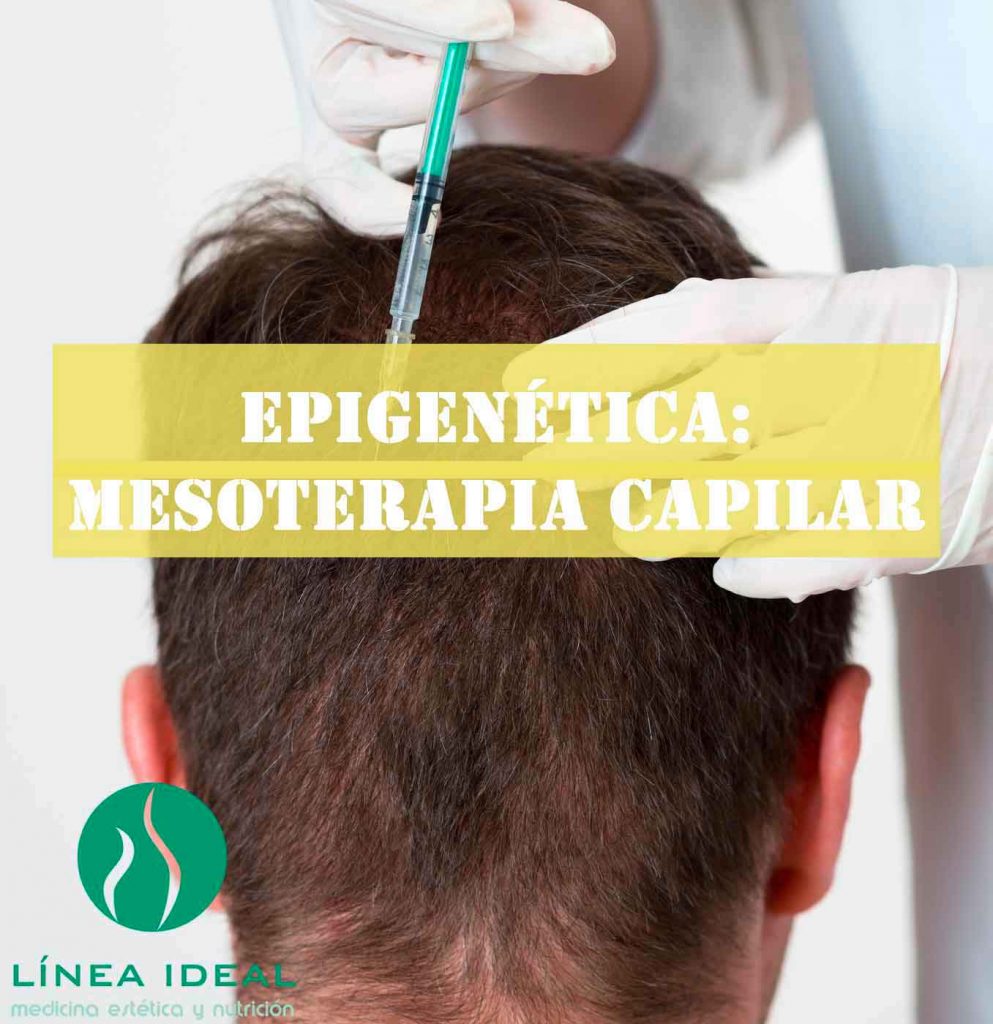 Blog Mesoterapia Capilar 1