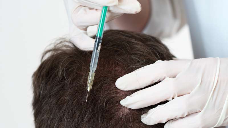 Tratamiento Tratamiento capilar Dr. CYJ Hair Filler 1