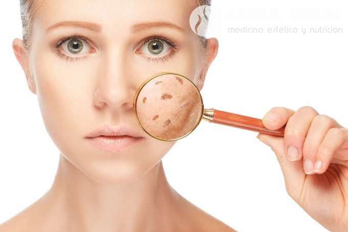 ¿Quieres saber cuáles son los mejores tratamientos para eliminar las manchas en la piel para que esté uniforme y radiante? 1 Blog ¿Quieres saber cuales son los mejores tratamientos para eliminar las manchas en la piel para que este uniforme y radiante 1