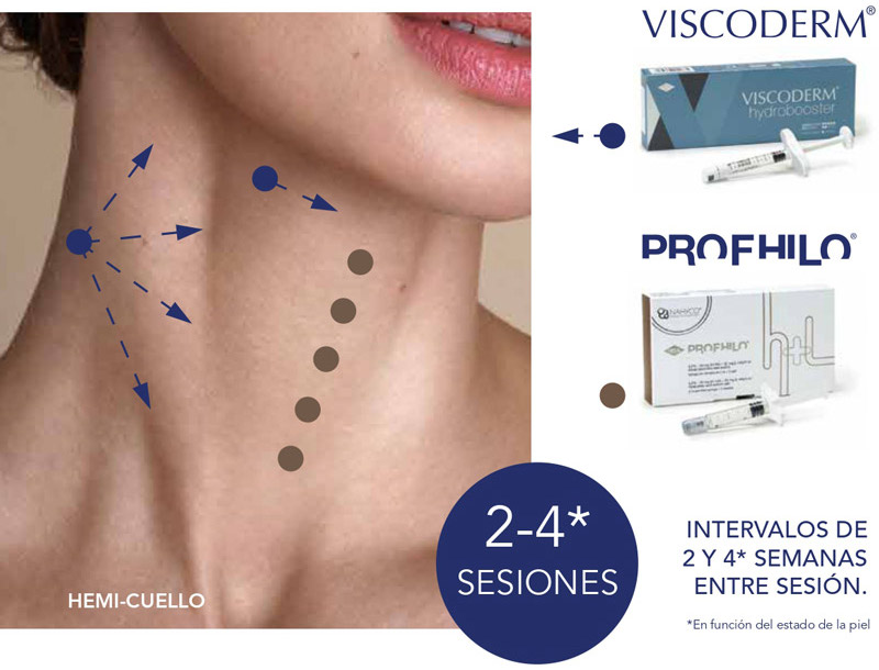 Blog Rejuvenecimiento de cuello con Profhilo y Viscoderm Hydrobooster 2