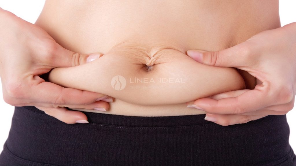 Blog Como reducir y eliminar la grasa localizada y la flacidez en tu abdomen con carboxiterapia y radiofrecuencia 1