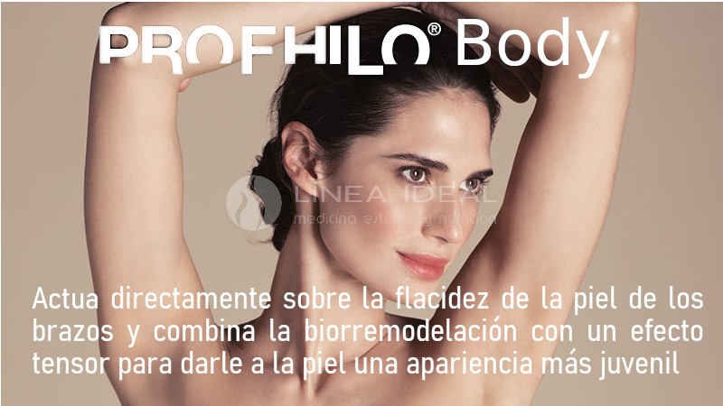 Blog Profhilo Body para mejorar la flacidez de los brazos 1