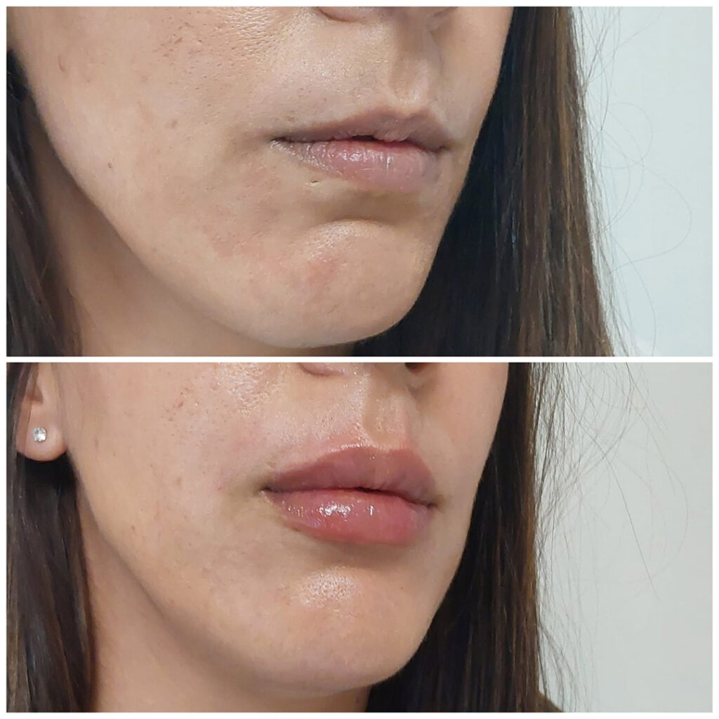 Labios Que Hablan De Ti: Realza Tu Belleza Sin Perder Tu Esencia 6 2025-06 Labios que hablan de ti, realza tu belleza sin 2