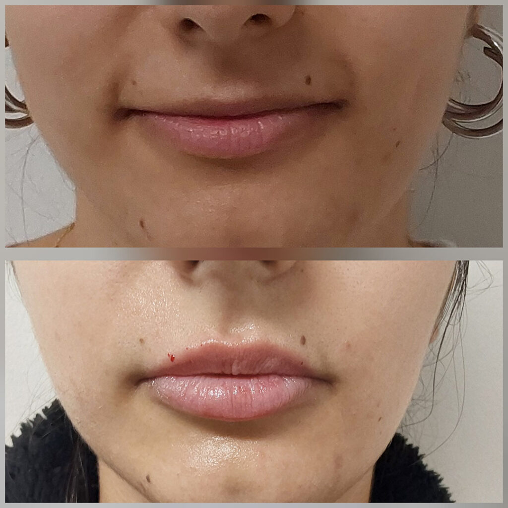 Labios Que Hablan De Ti: Realza Tu Belleza Sin Perder Tu Esencia 3 2025-06 Labios que hablan de ti, realza tu belleza sin 3
