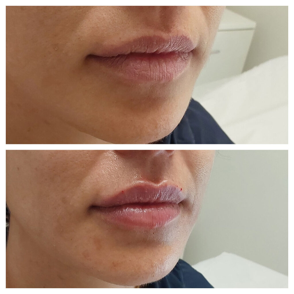 Labios Que Hablan De Ti: Realza Tu Belleza Sin Perder Tu Esencia 5 2025 06 Labios que hablan de ti realza tu belleza sin 5