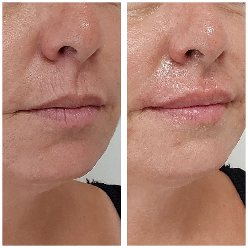 Labios Que Hablan De Ti: Realza Tu Belleza Sin Perder Tu Esencia 2 2025 06 Labios que hablan de ti realza tu belleza sin 6
