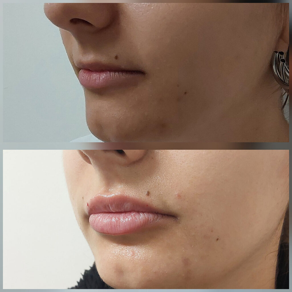Labios Que Hablan De Ti: Realza Tu Belleza Sin Perder Tu Esencia 4 2025-06 Labios que hablan de ti, realza tu belleza sin4